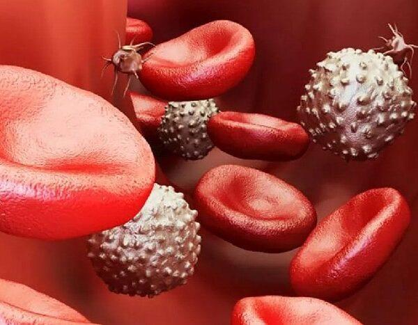 Anticoagulantes Hematologo Guayaquil Especialista Dra. Carolina Moreira-min